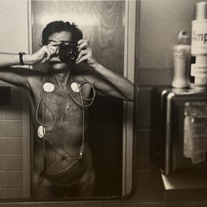Autoportrait à l’électrocardiogramme, circa 1970-1980